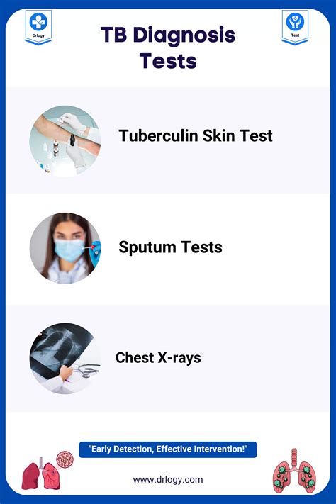TB Testing & Diagnosis .